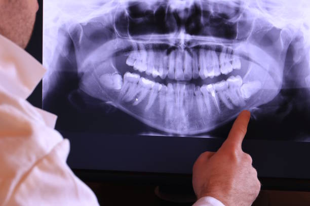 Best Emergency TMJ Treatment in Conesus Lake, NY