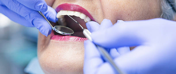 Best Urgent Care for Lost Fillings or Crowns in Conesus Lake, NY
